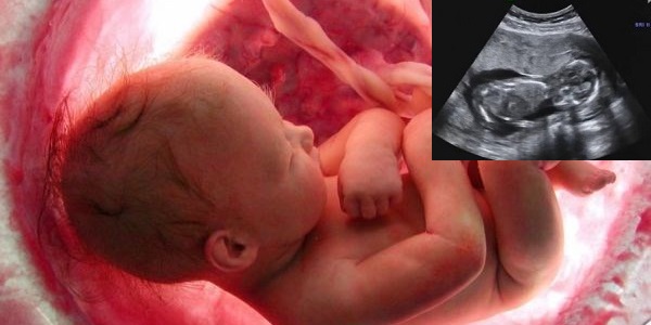 Janin Dalam Kandungan.jpg