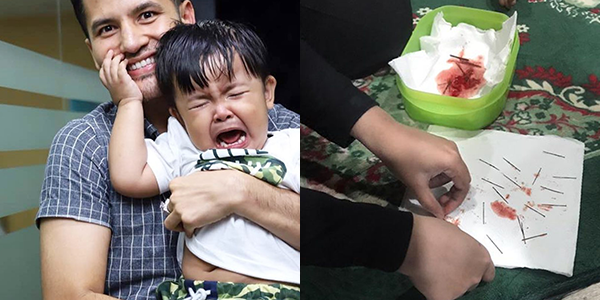 Tergamak Sungguh! Kesian Adik Anas Sekeluarga, Disίhir Individu Tak Berhati Perut