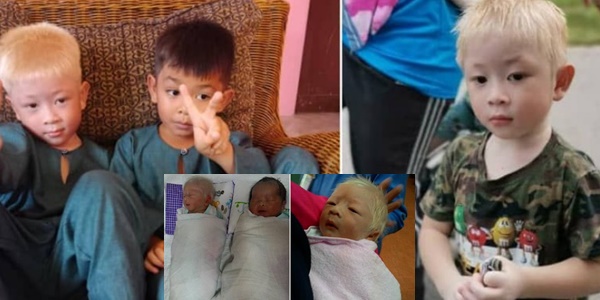anak versi rare